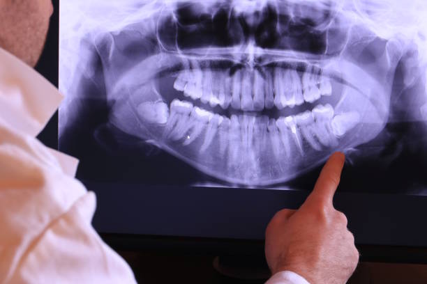 Best Emergency Dentist for Knocked-Out Tooth in Stlman Valley, IL